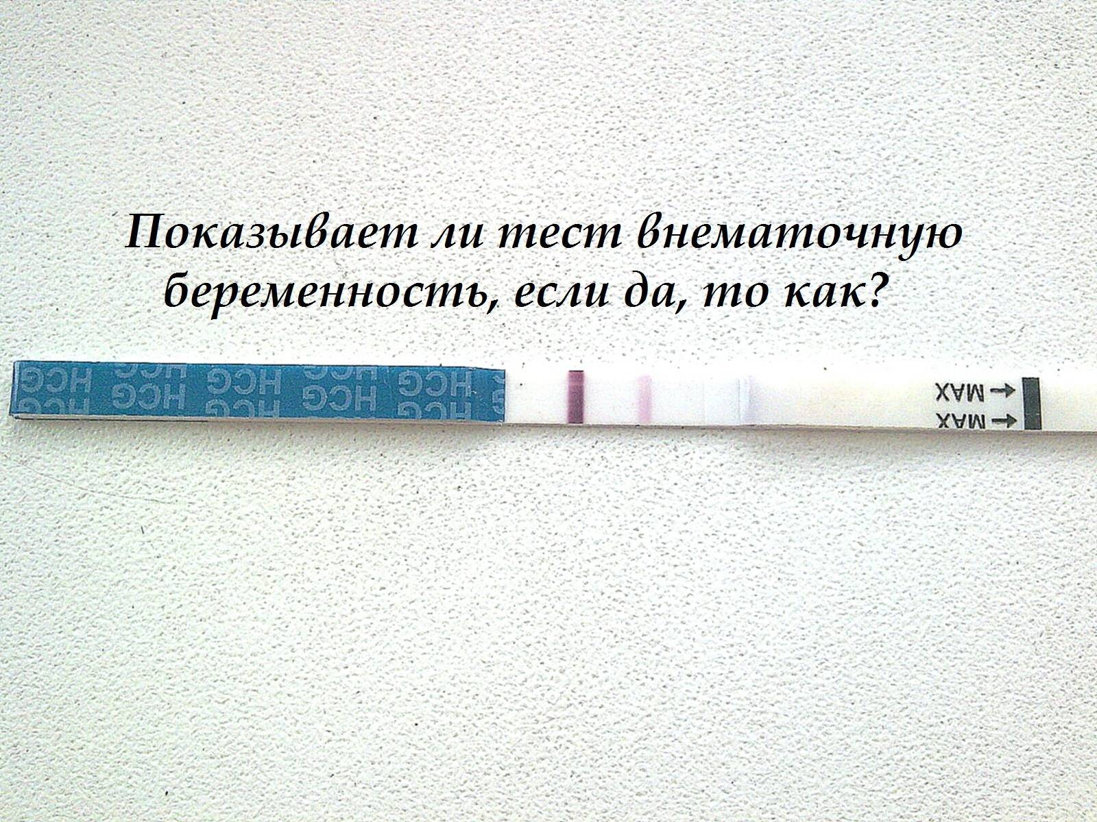 Внематочная беременность. причины, симптомы, диагностика и лечение :: polismed.com