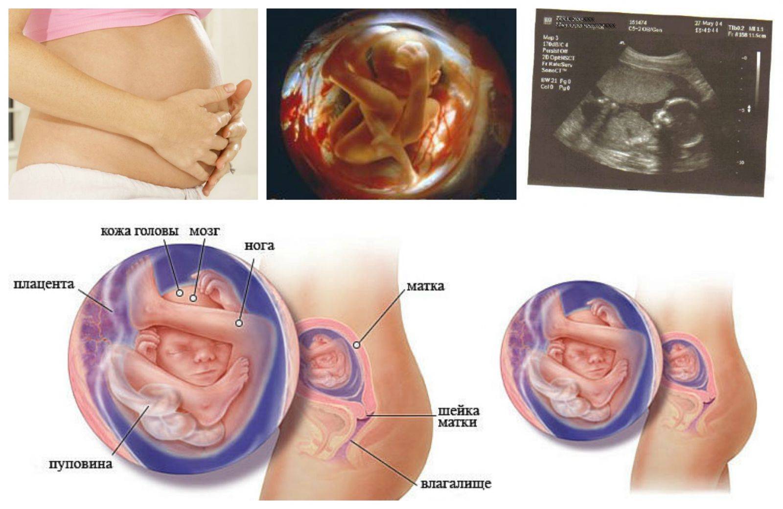 18 неделя беременности - развитие ребенка, фото животиков, правильное питание, увеличение веса, второй скрининг