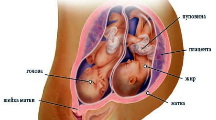 Многоплодная беременность: 7 признаков | nestle baby