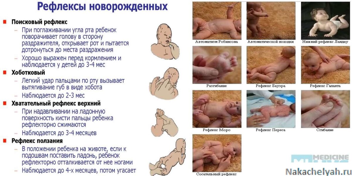 Рефлексы новорожденных: условные и безусловные