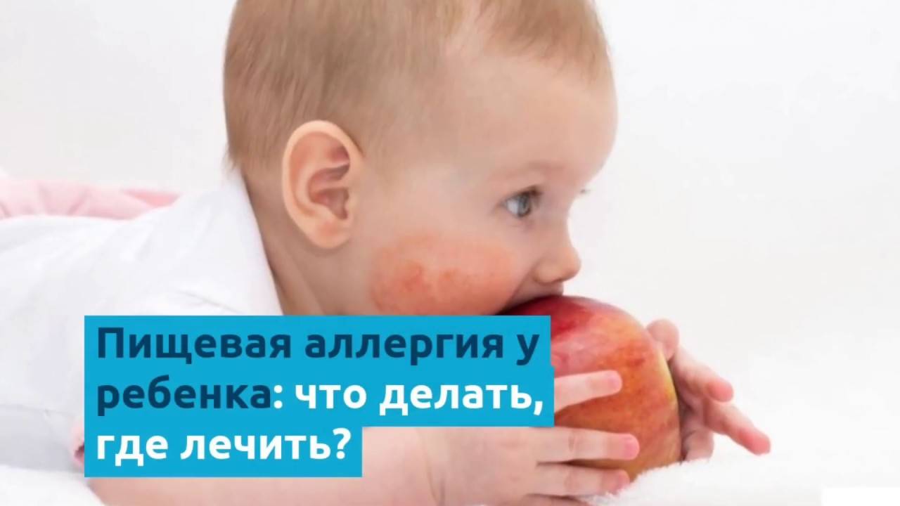 Аллергия у новорожденных - симптомы и причины, как проявляется у ребенка и чем лечить