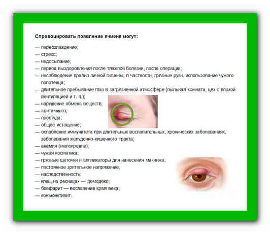 Как лечить ячмень на глазах ребенка ???? информационный портал детское зрение