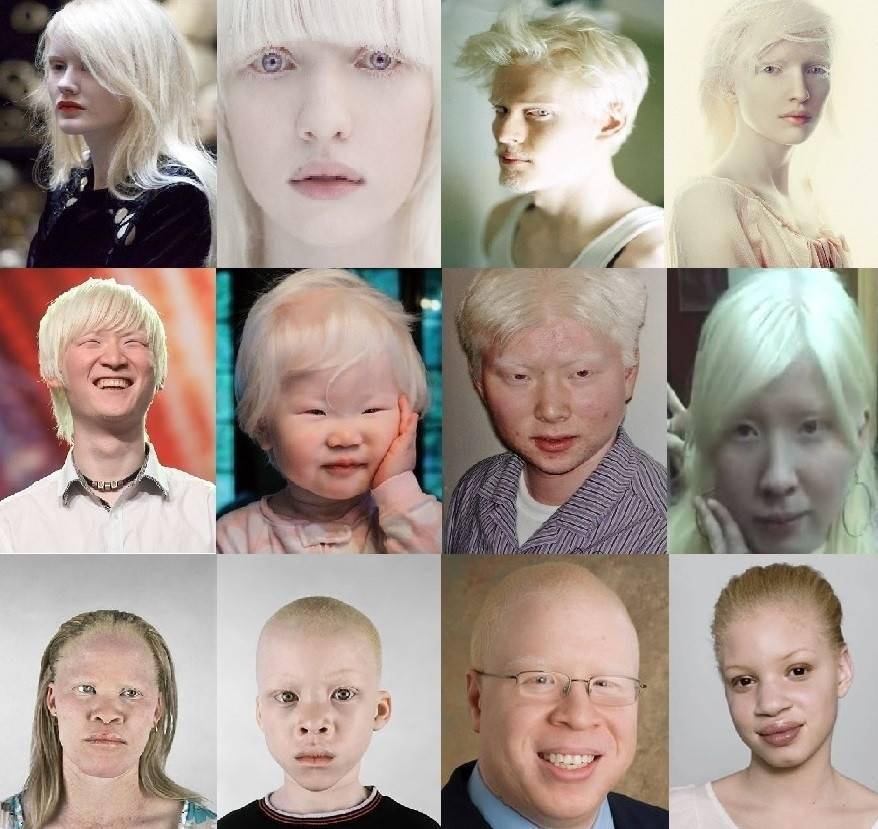 Альбинизм - рассказовская црб