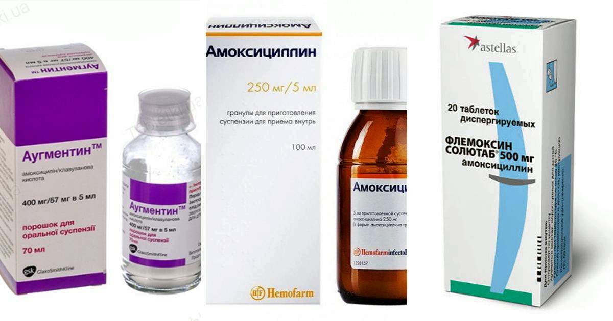 Аугментин при гв и можно ли избежать приема антибиотиков при гайморите - грудное вскармливание - страна мам