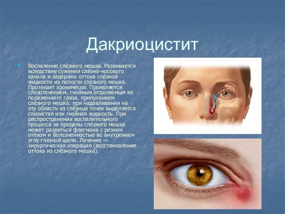 Закатывания глаз у детей: причины и помощь