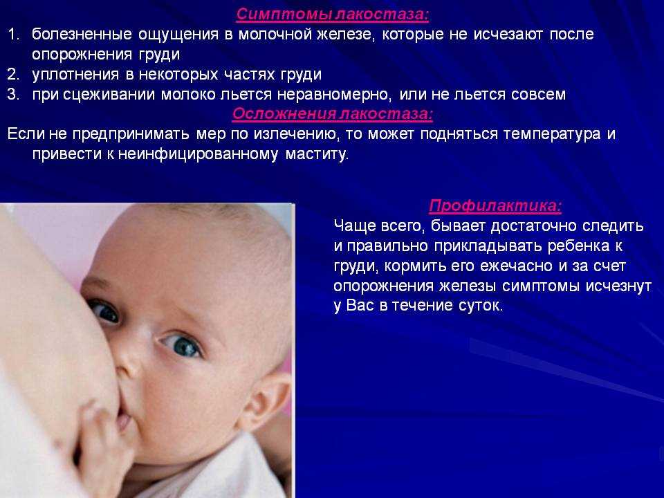 Лактостаз у кормящей матери: симптомы и лечение в домашних условиях - советы от экспертов