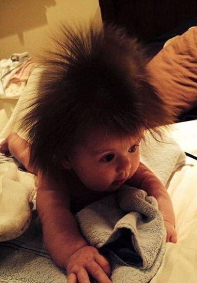 Могут ли дети родиться с волосами. Младенец с волосами. Ребенок с шевелюрой. Новорожденные дети с волосами.