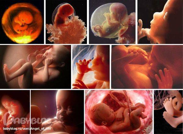 7 признаков замершей беременности на ранних сроках: причины и диагностика