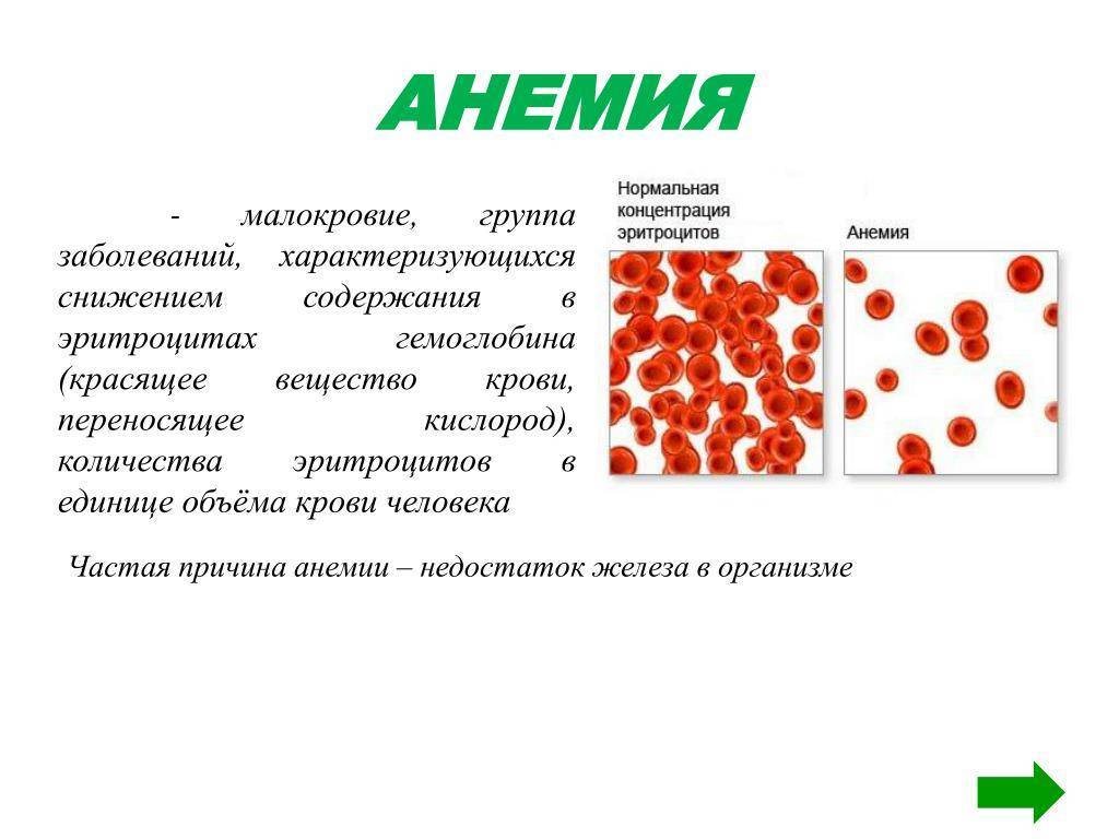 Анемия у детей - лечение, симптомы, профилактика и диагностика анемии | см клиника