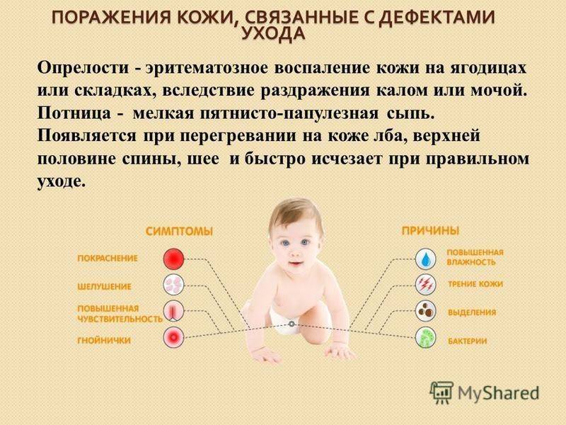 Потничка у новорожденных на лице: лечение и профилактика