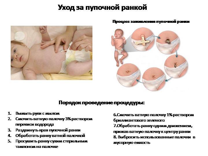 Утренний туалет новорождённого: проведение необходимых ежедневных процедур и советы по уходу за ребенком