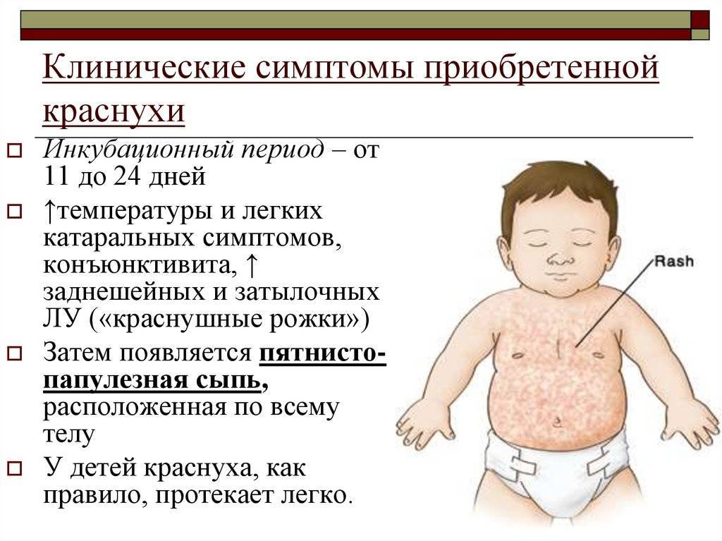 Розеола детская: фото сыпи, причины, симптомы, лечение (комаровский)