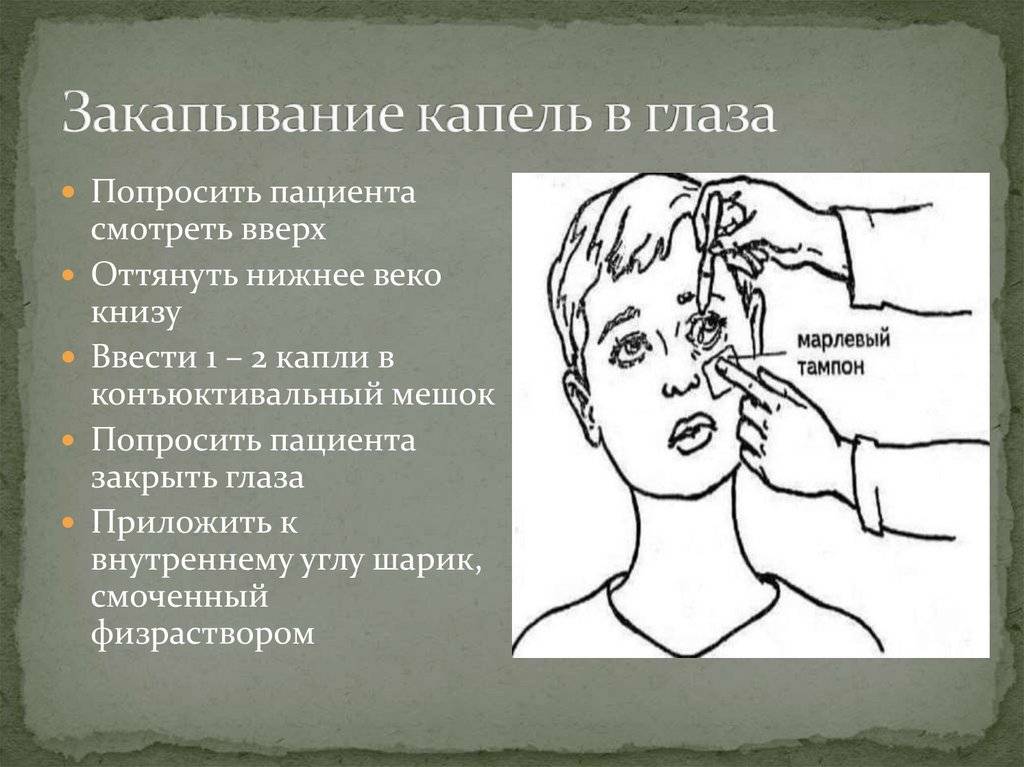 Как правильно закапывать капли в нос ребенку: 3 важных правила, психологические аспекты