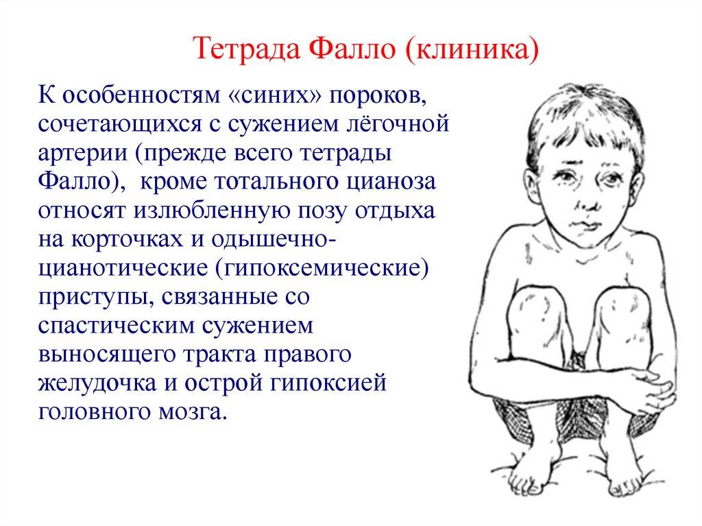 Цианоз | симптомы | диагностика | лечение - docdoc.ru