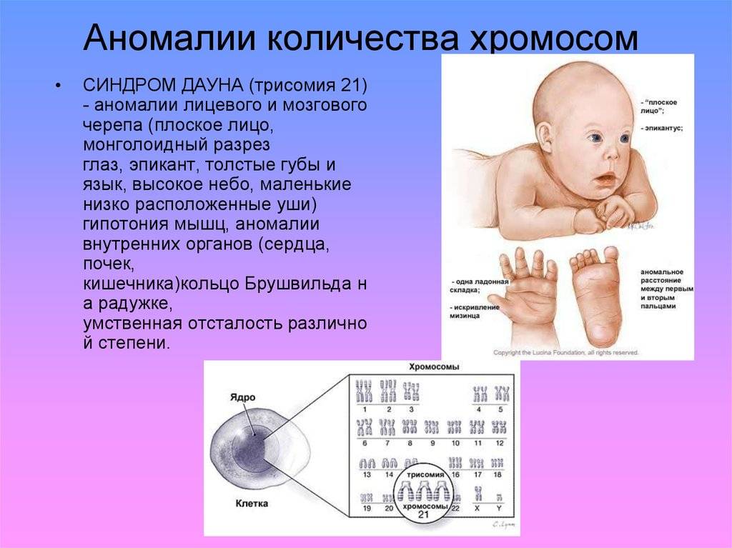 ✅ синдром патау: 7 признаков поражения органов и систем - ik-rt.ru