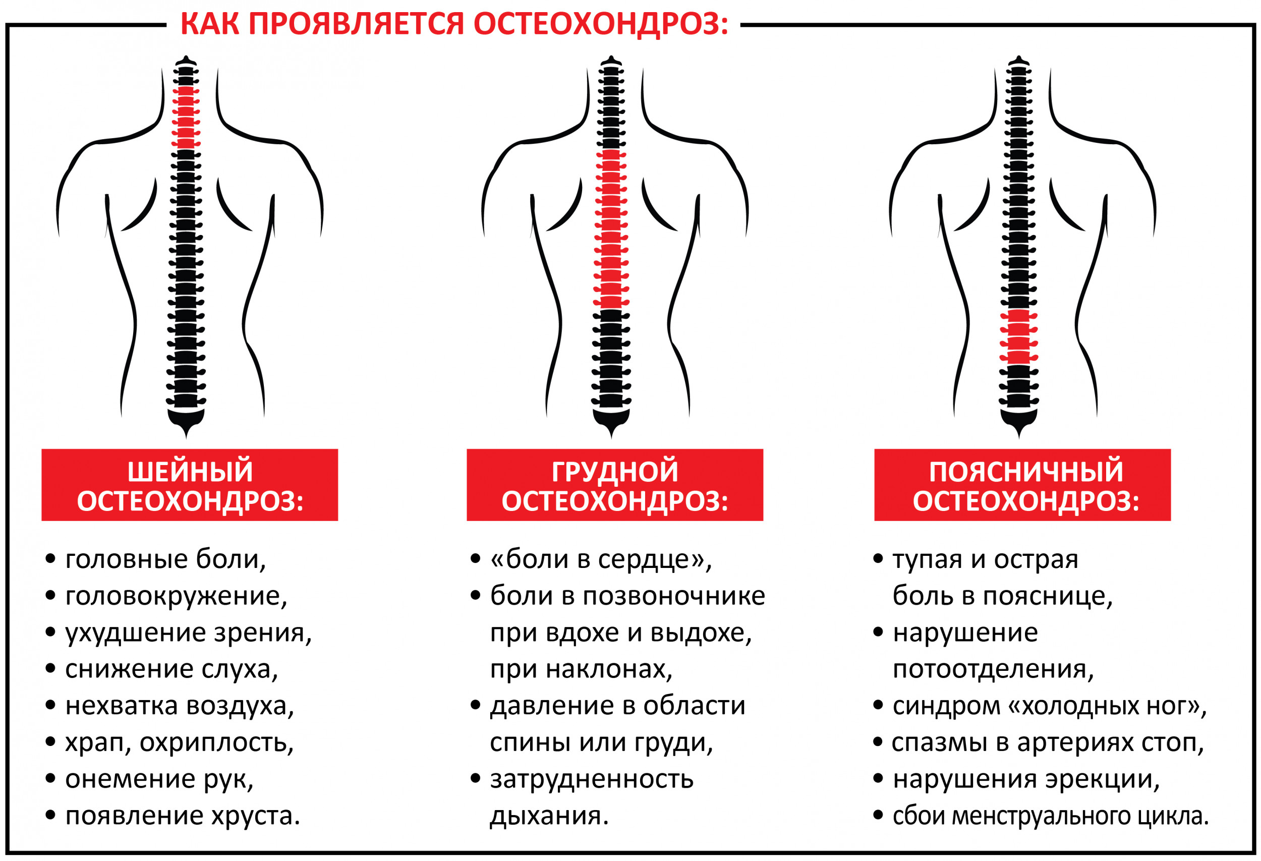 Шейно-грудной остеохондроз