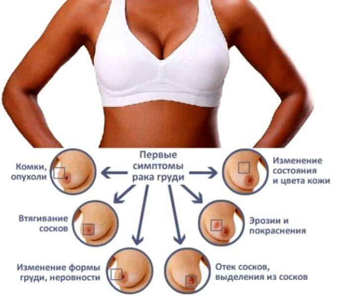 Почему нет месячных...