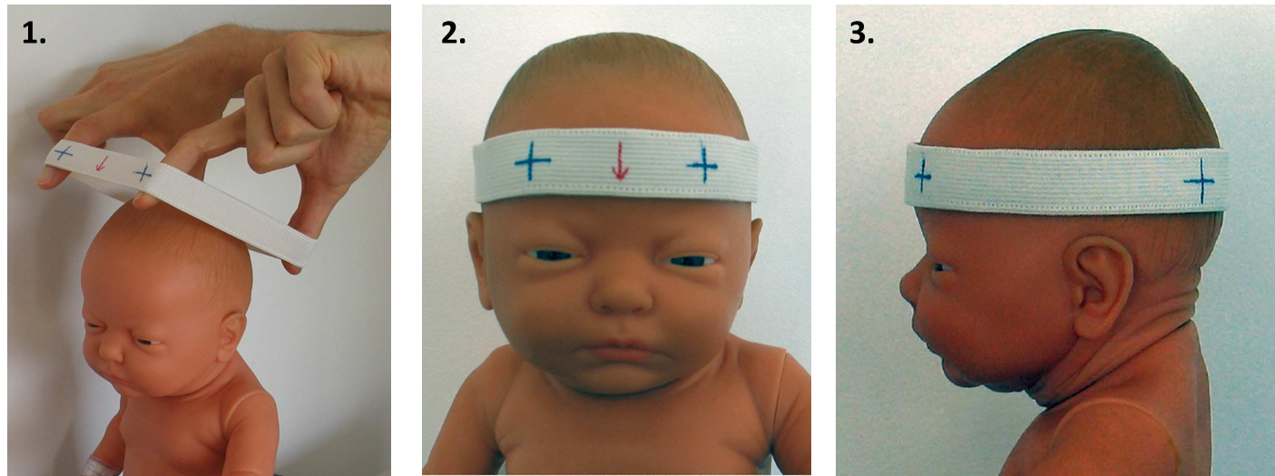 Можно ли исправить форму черепа у ребенка. что делать, если неровная голова у ребенка
