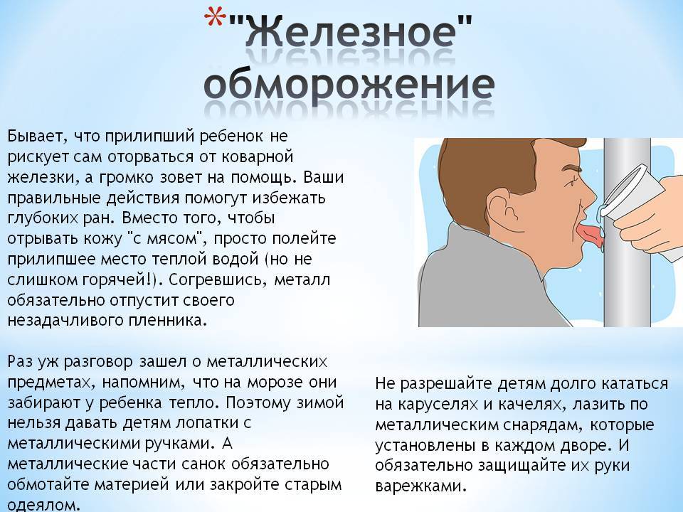 Что делать, если прилип язык на морозе к металлу. что делать, если ребенок примерз языком к железу зимой: меры первой помощи