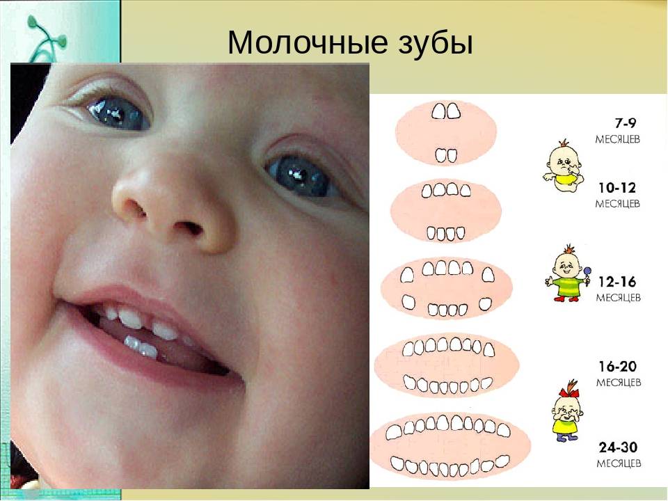 Температура на зубы как отличить. Молочные зубы у детей.