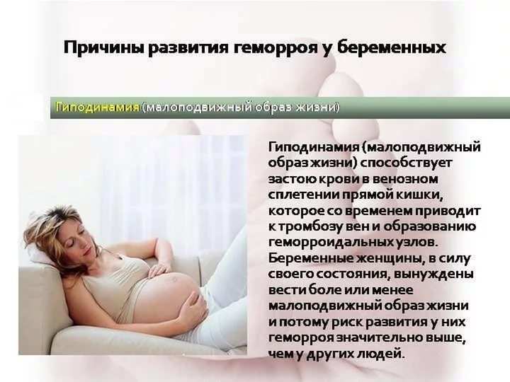 Лечение геморроя при беременности