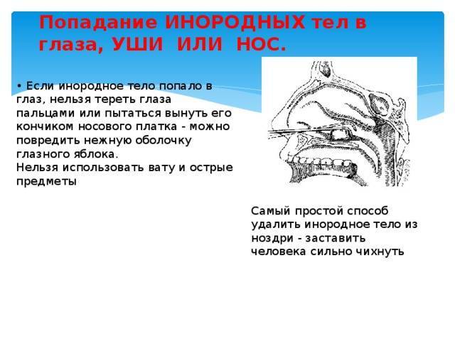 Инородные тела у детей: симптомы, неотложная помощь