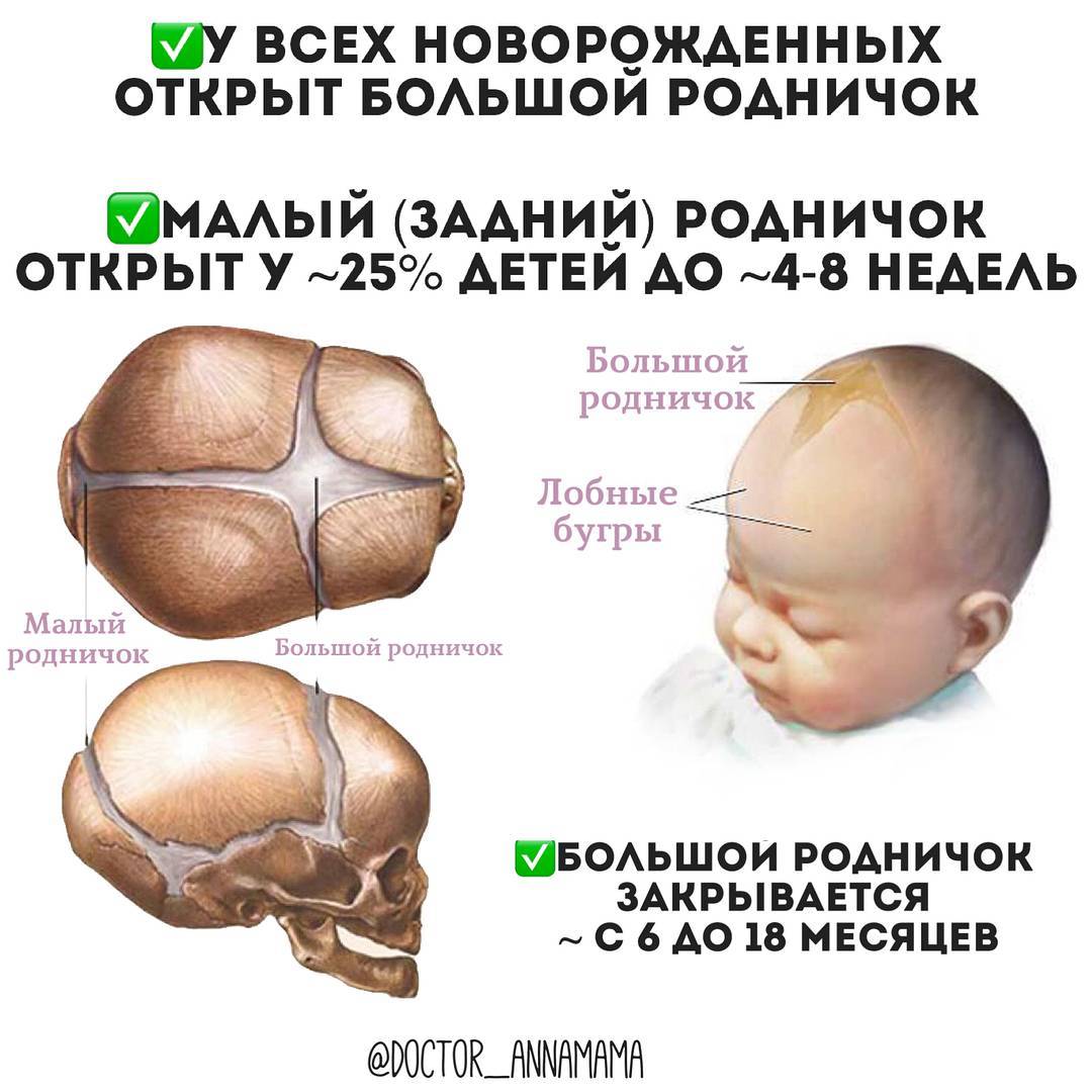 Родничок у новорожденных фото и норма