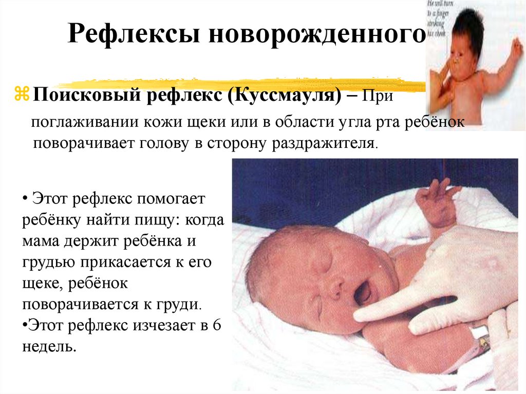 Рефлексы сработали. Поисковый рефлекс Куссмауля у новорожденных. Хоботковый рефлекс новорожденного. Поискоаый рефлект кусамауля. Поисковый рефлексноворожденых.