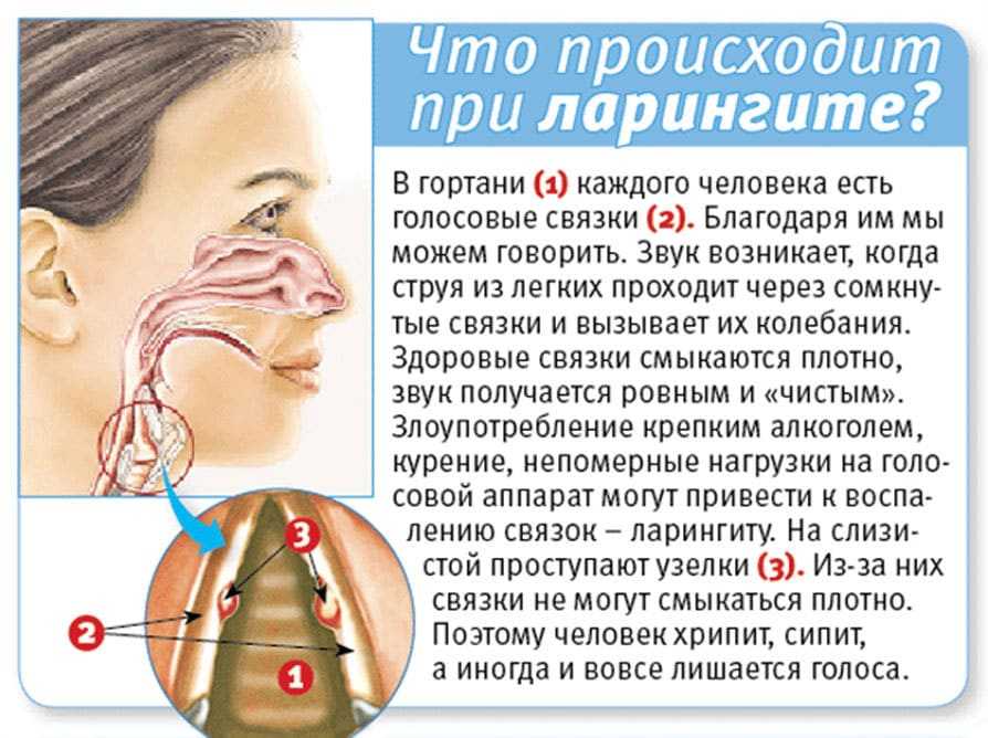Осипший голос у грудного ребенка: причины и методы лечения без сопутствующих симптомов простуды