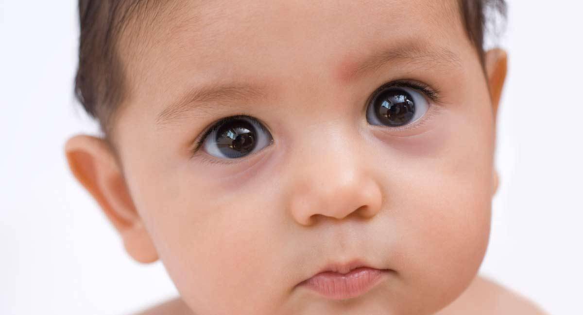 Синяки и круги под глазами у новорожденного ребенка до года