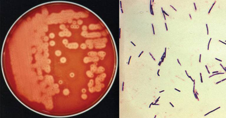 Бактериологическое исследование кала: показания и противопоказания | food and health