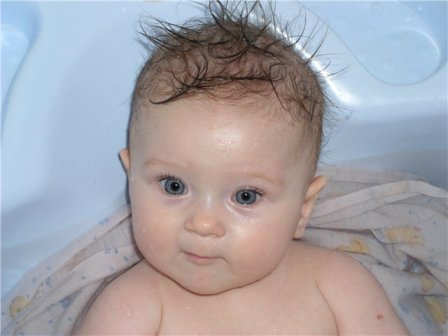 У ребенка плохо растут или выпадают волосы: причины, витамины для роста и мнение доктора комаровского