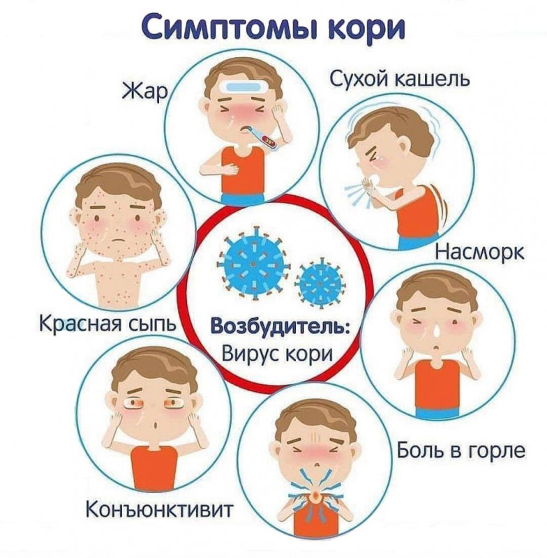 Корь-симптомы у детей, лечение, профилактика и первые признаки кори