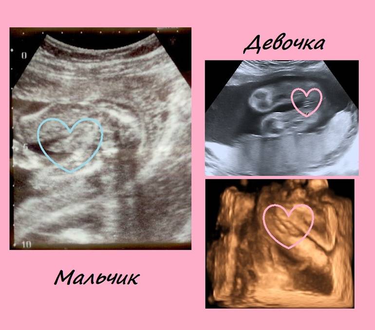 Как определить пол будущего ребенка: 8 способов, от научных до народных методов - agulife.ru