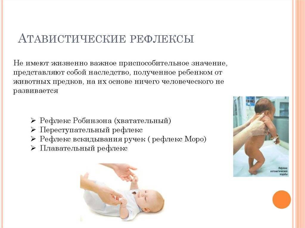 Безусловные рефлексы новорожденного [что это такое]: рефлексы моро, галанта и другие примеры