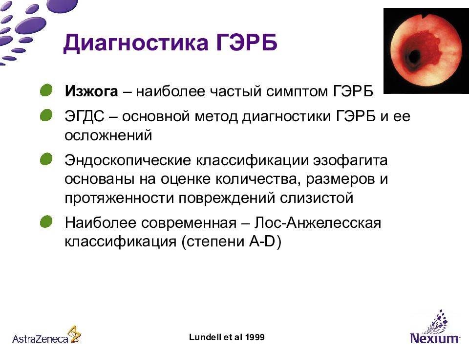 Лечение эзофагита в россии, саратове 