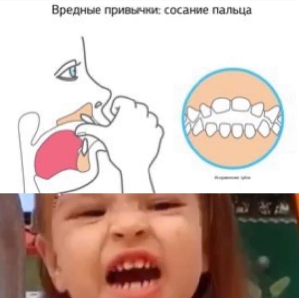 Ребенок сосет палец: почему и как отучить?