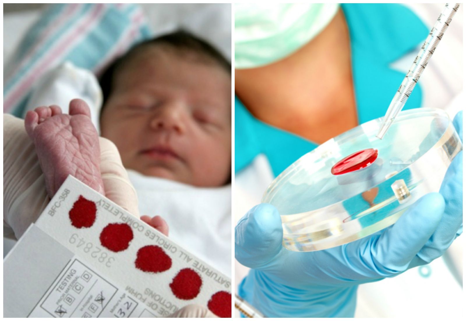 Какие анализы берут у новорожденных в роддоме и зачем
