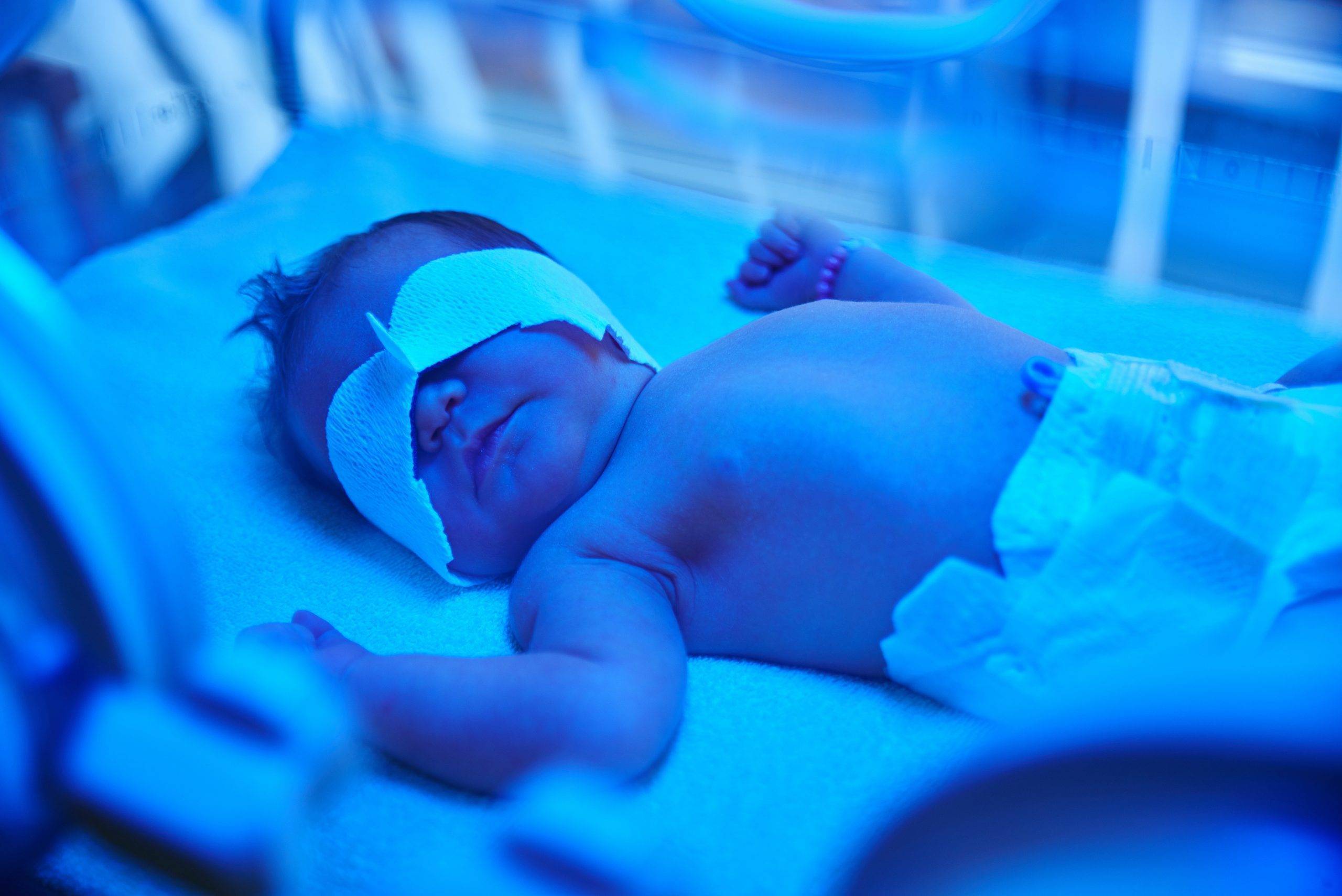 Желтуха новорожденных (неонатальная желтуха). причины, виды, классификация, симптомы и признаки