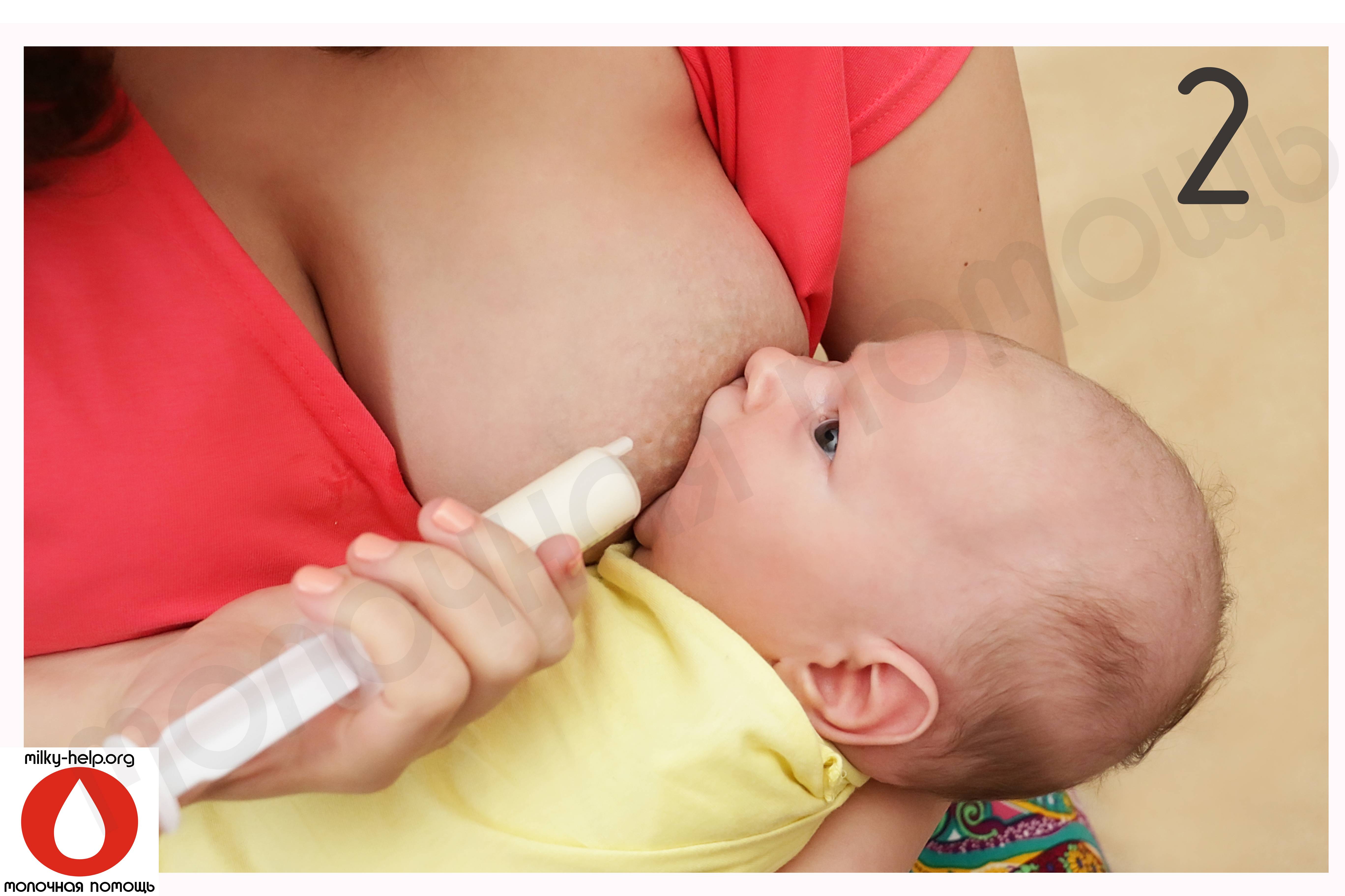 Укус соска. Система докорма SNS для грудничка. Система для докорма грудничков новорожденных. Система докорма для новорожденных Medela. Дополнительная система кормления SNS.