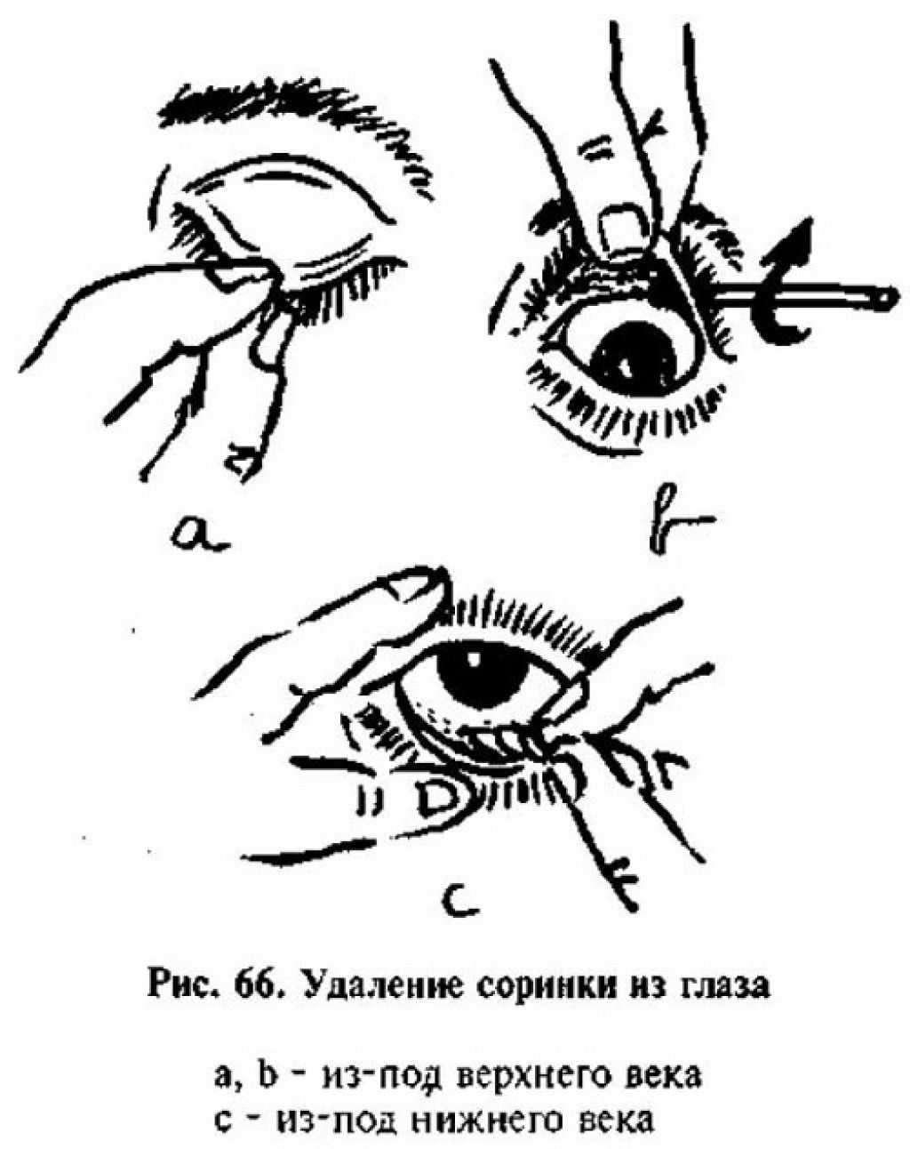 Чем промыть глаз если что то попало