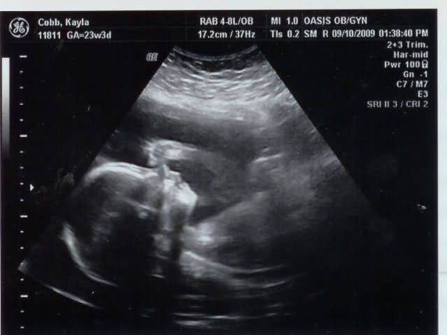 23 неделя беременности: что происходит с ребенком, развитие и шевеление плода, выделения у мамы, фото узи / mama66.ru