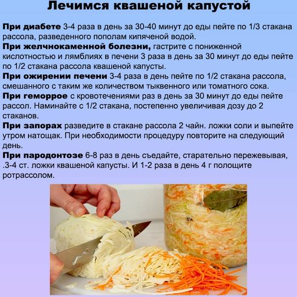 Можно ли капусту при грудном вскармливании (цветная, морская, тушеная, квашеная) | womanroutine.ru