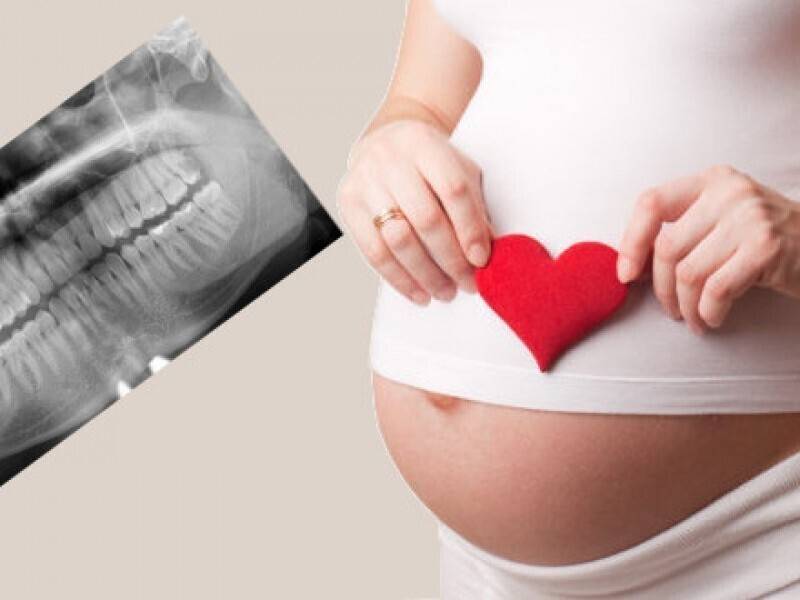Удаление зуба при беременности, анестезия, сроки, триместры.