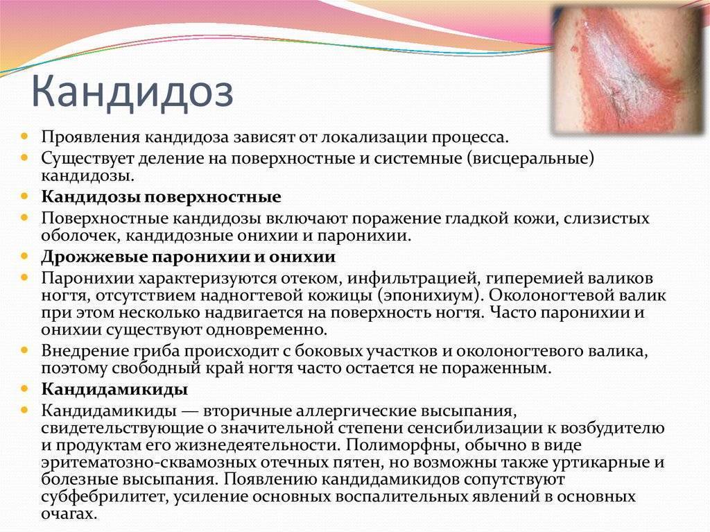 Молочница – причины, симптомы и лечение | московская венерология