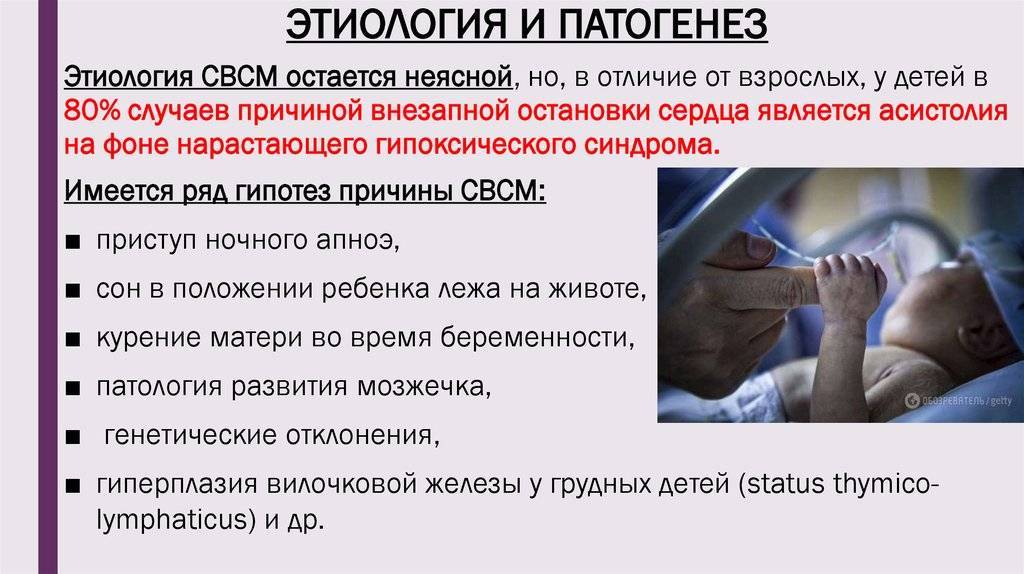 Синдром внезапной детской смерти — все, что нужно знать родителям