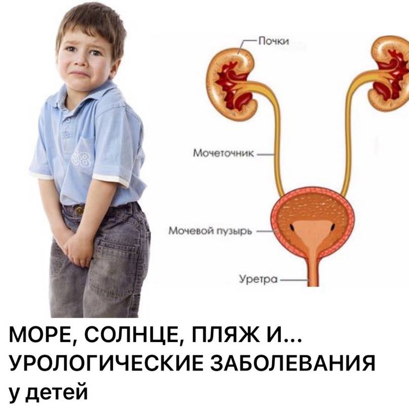 Цистит у детей: все о заболевании