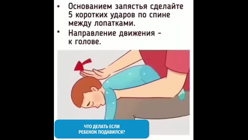 Что делать, если грудничок подавился и задыхается