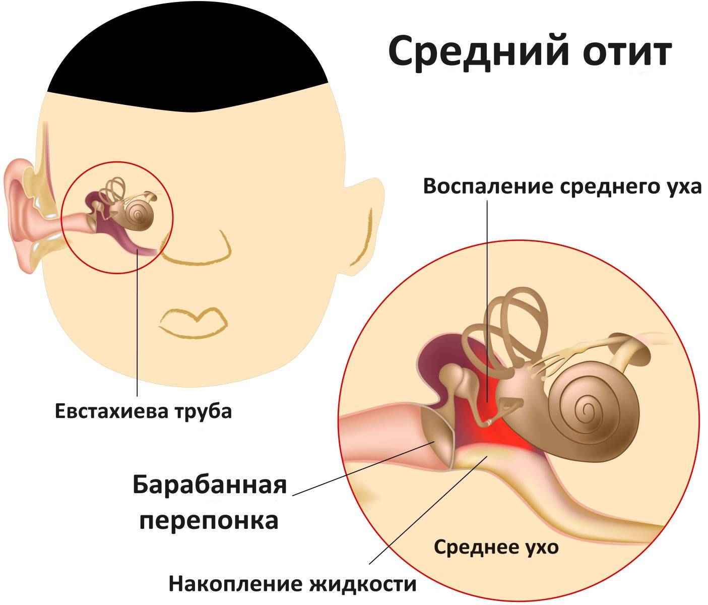 Боль в ухе – не всегда первичный симптом!