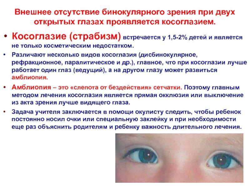 Косоглазие у детей (у ребенка): причины, лечение, операция - moscoweyes.ru - сайт офтальмологического центра "мгк-диагностик"
